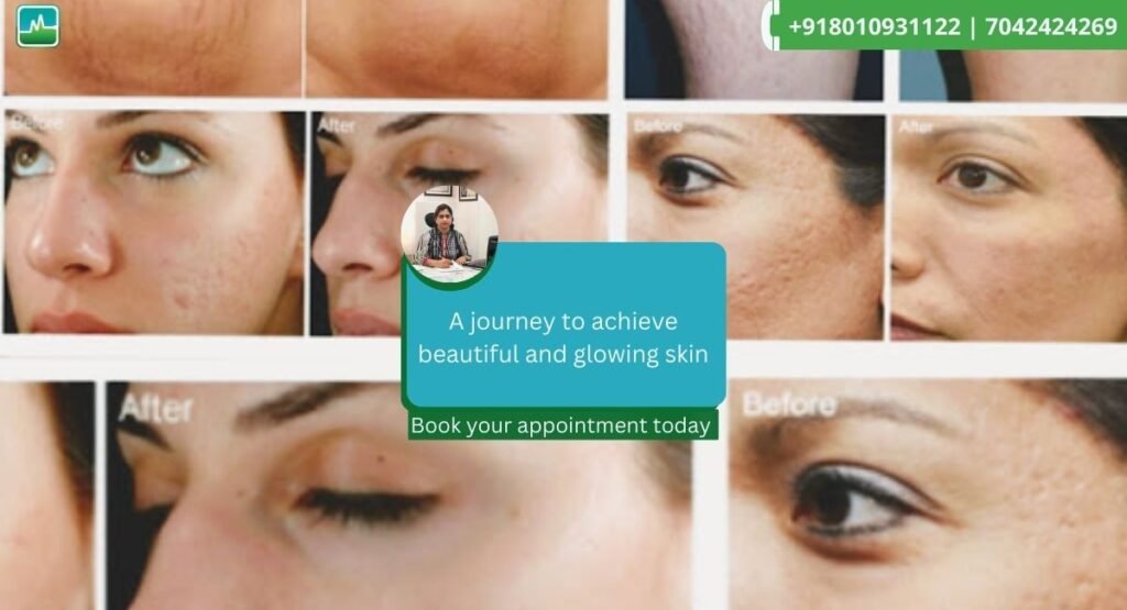 Best skin allergy treatment in Gurgaon